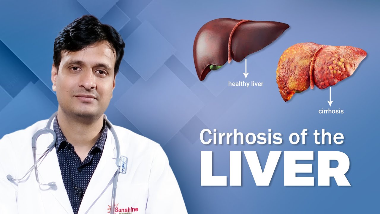 Everything You Need To Know About Liver Cirrhosis | Dr. Shakti Prasad Choudhury