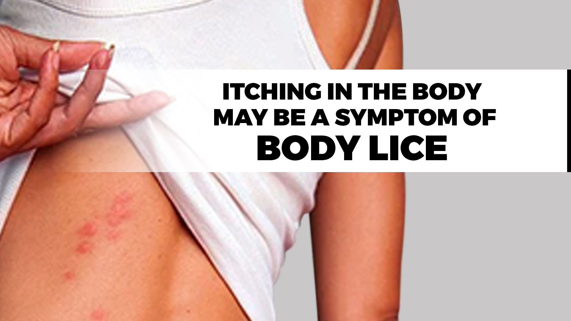 Itching in the body, may be a symptom of body lice