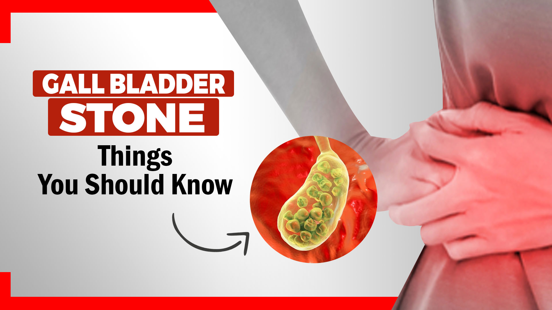 Gall bladder stone- Things you should know