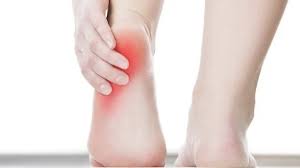 heel pain