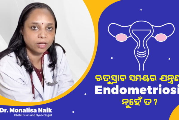 endometriosis