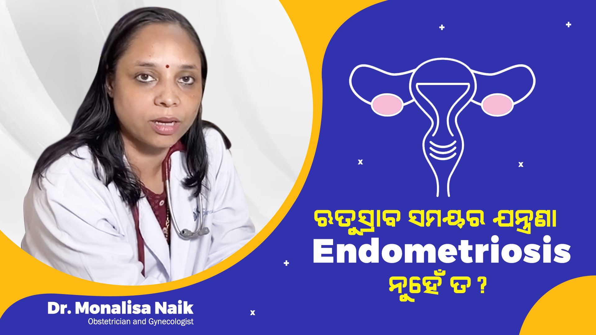 Endometriosis- Diagnosis and treatment