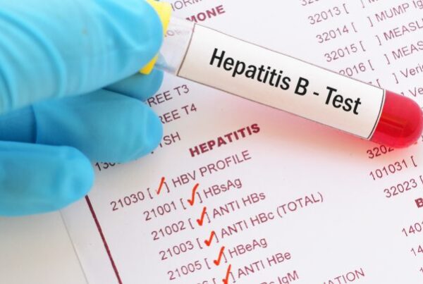 hepatitis