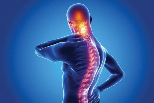 spondylitis