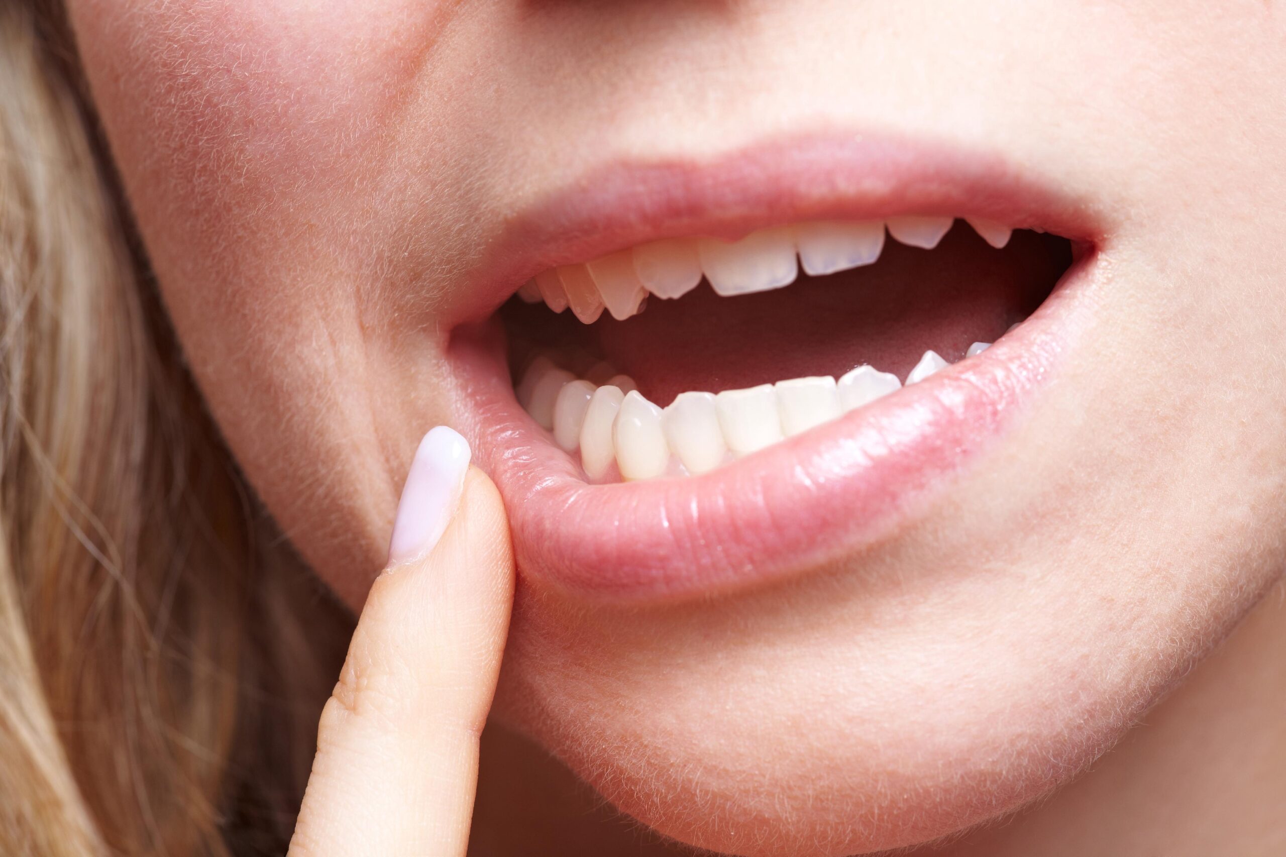 Understanding Bell’s Palsy: Causes, Symptoms, and Treatment