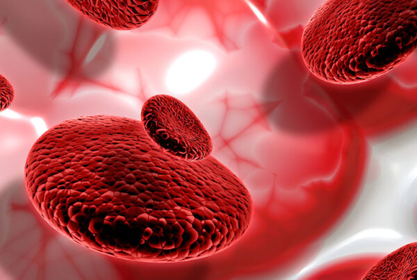 Thalassemia.
