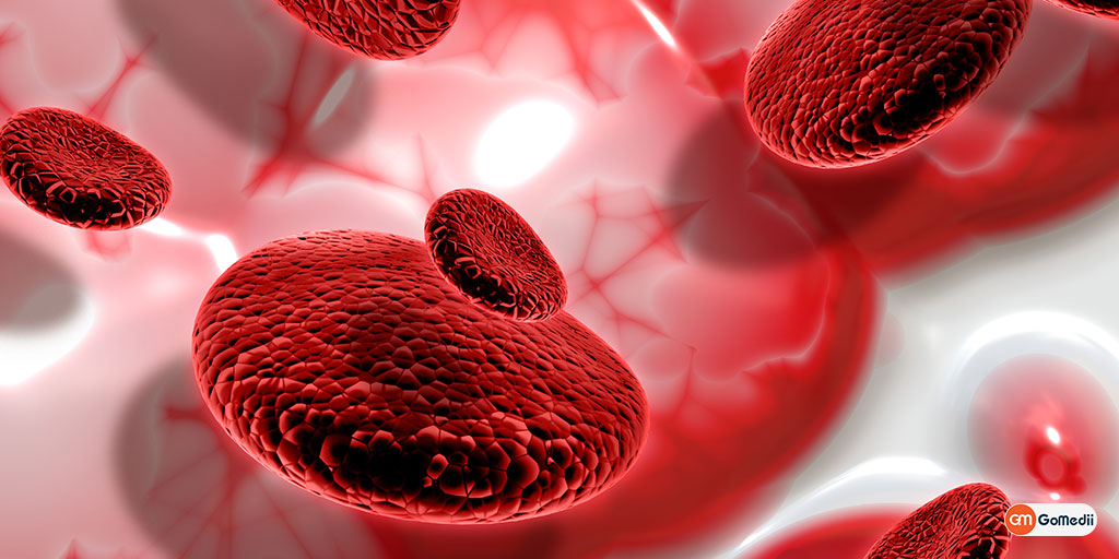 Thalassemia: Understanding the Silent Genetic Disorder Affecting Millions Worldwide