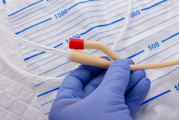 catheter