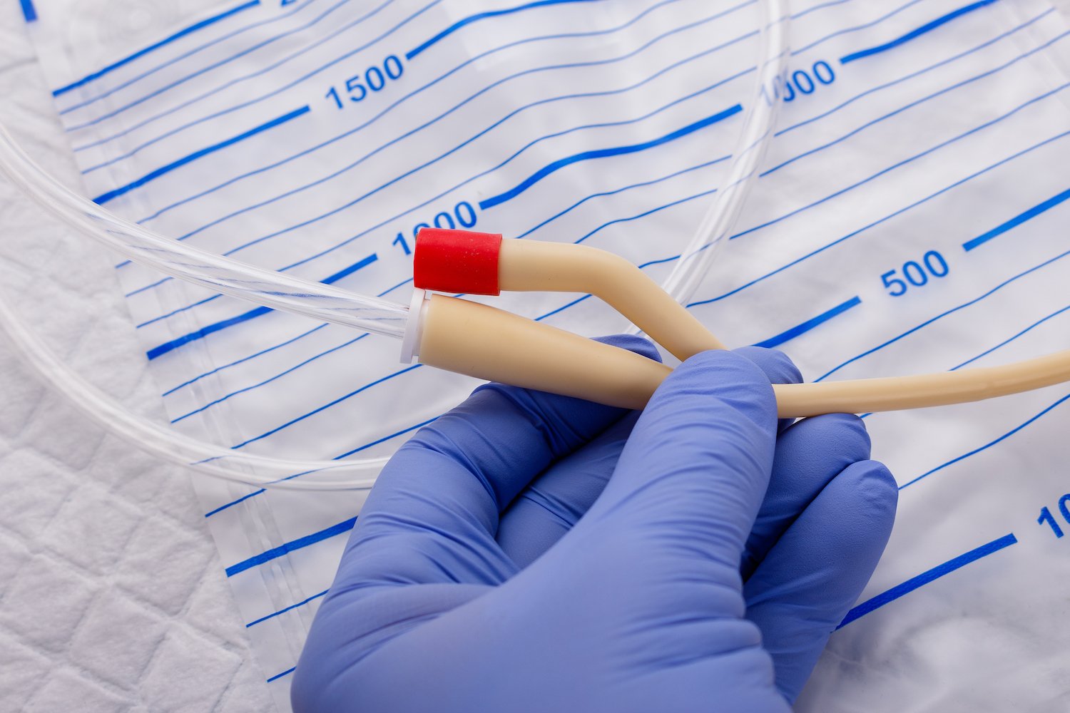 AIIMS‑Led Study Reveals Widespread Catheter‑Related Bloodstream Infections Across Indian ICUs