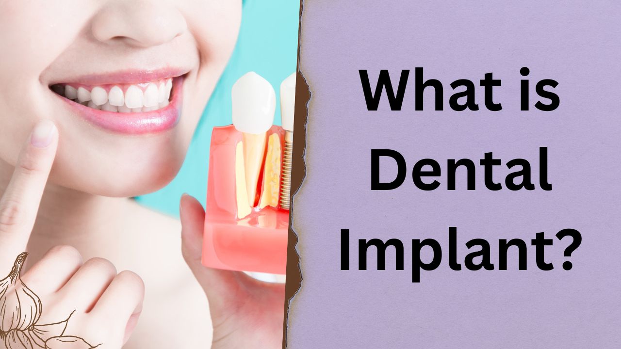 Dental Implants Transform Oral Care: Insights from Dr. Milan Kumar