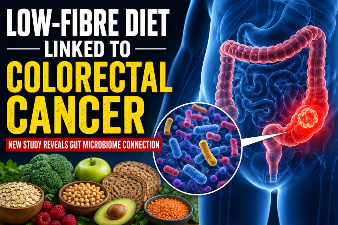 Low-Fibre Diet May Increase Colorectal Cancer Risk by Altering Gut Microbiome: Study