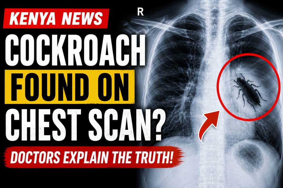 Cockroach Spotted on Chest Scan? Doctors Reveal the Surprising Truth Behind Viral Medical Case