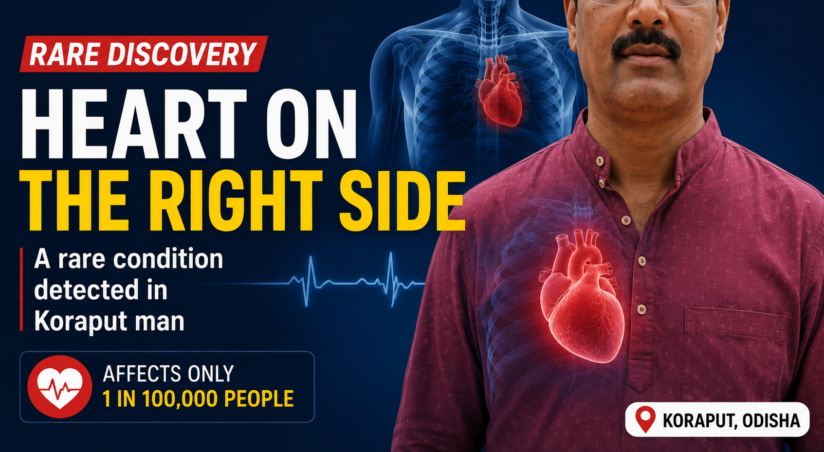 Heart on the Right Side? The Rare Condition That Stunned Doctors in Koraput